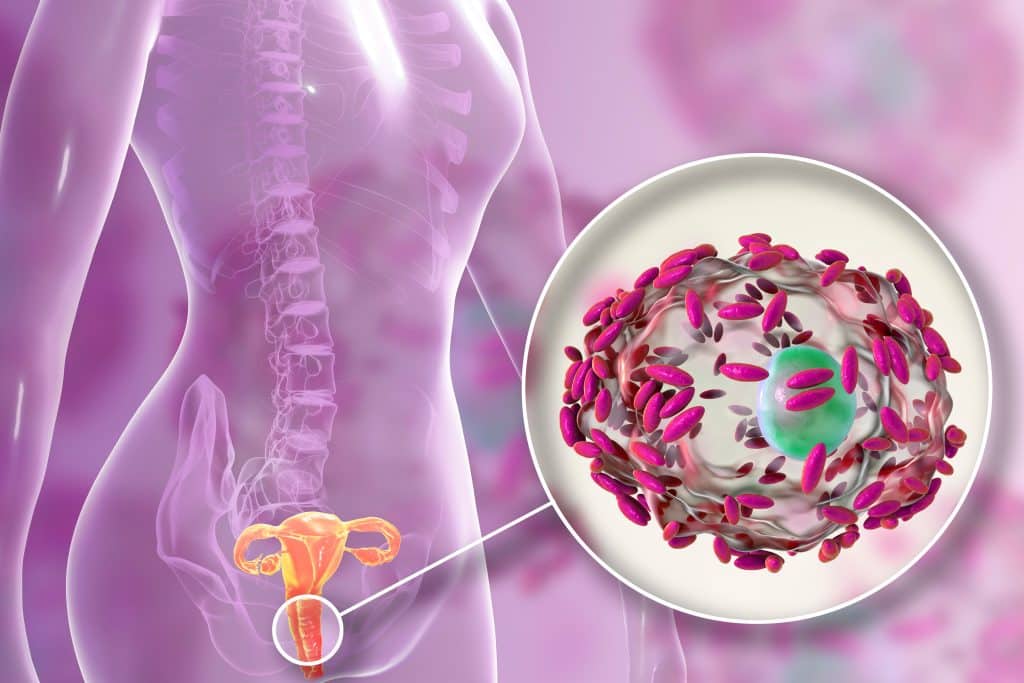 Qu'est-ce qui déséquilibre la flore vaginale ? 