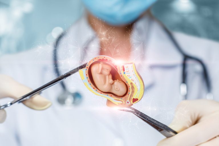 Quelles sont les étapes d&rsquo;un transfert embryonnaire en PMA ?
