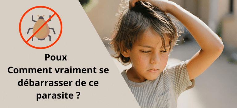 Poux : comment vraiment se débarrasser de ce parasite ?