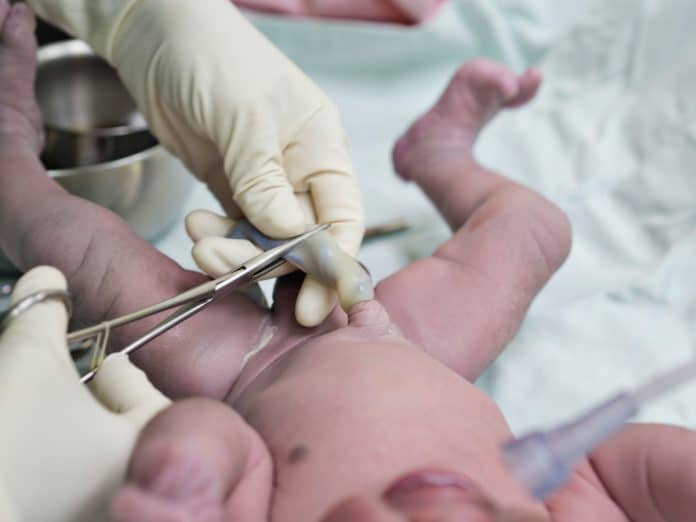 Le cordon ombilical d'un nouveau-né est coupé par des mains gantées à l'aide de ciseaux chirurgicaux, après clampage tardif du cordon. Le bébé, bénéficiant des bienfaits de l’intervention pour le nouveau-né, est allongé sur un champ médical avec du matériel médical à proximité.